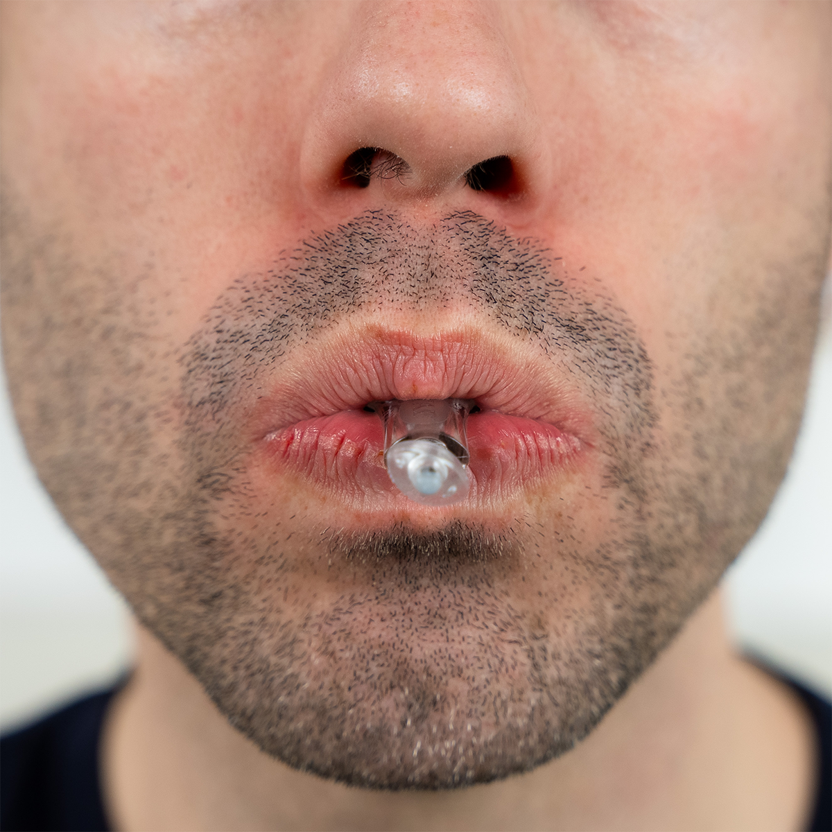 myTAP Oral Appliance for Sleep Apnea