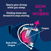 SmartGuard Anti-Snore Device
