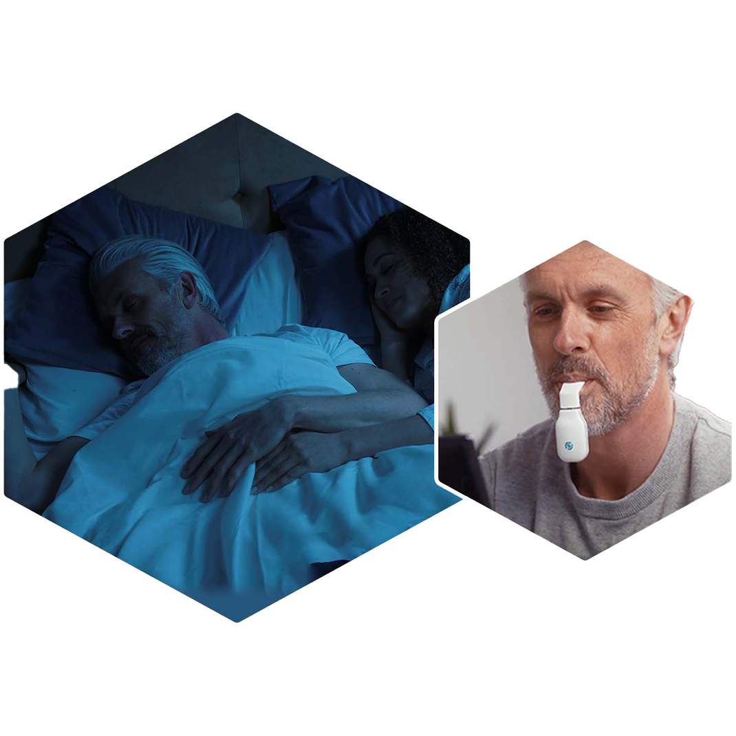 exciteOSA Tongue Stimulator for Sleep Apnea
